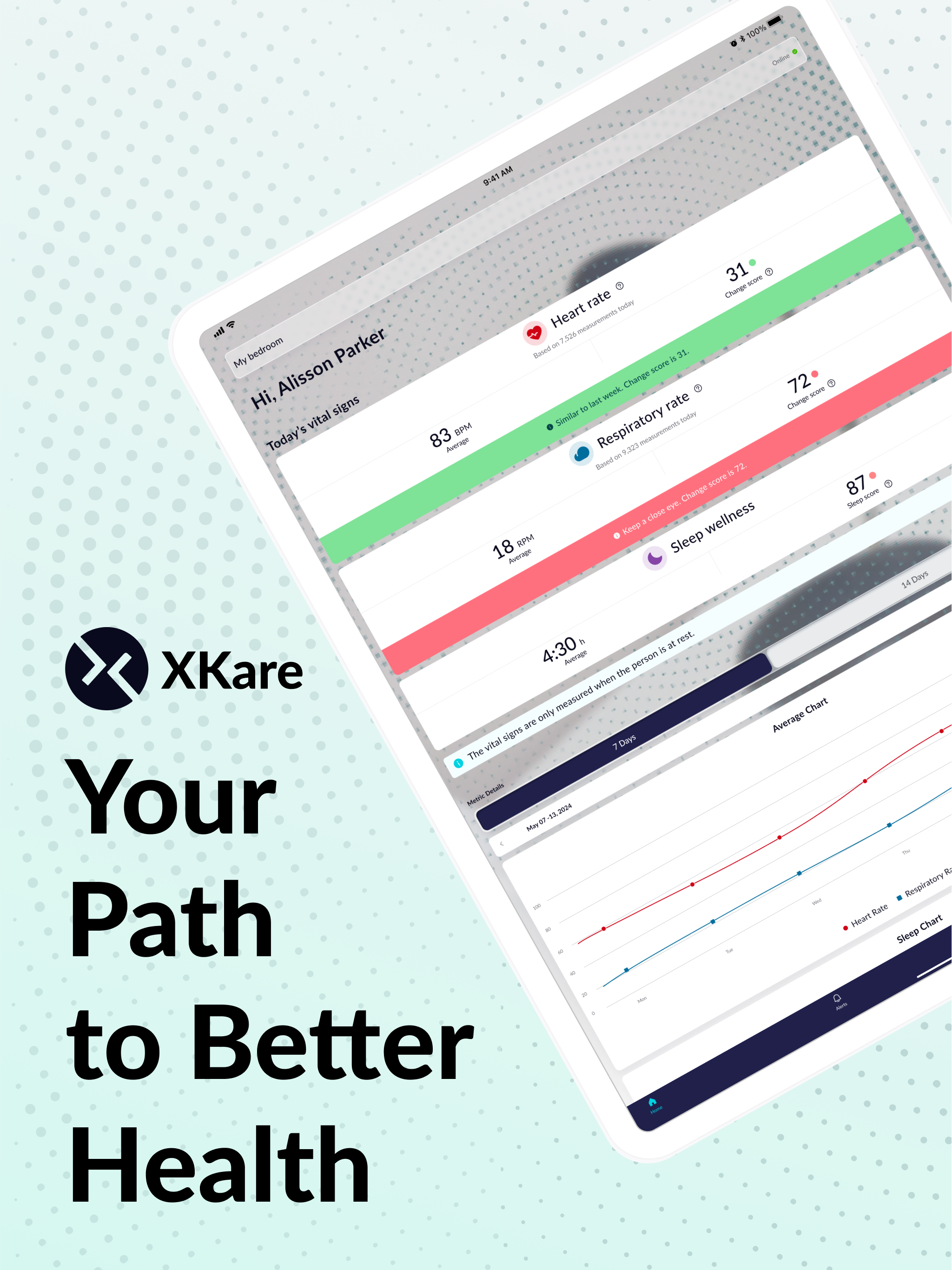 XKare
