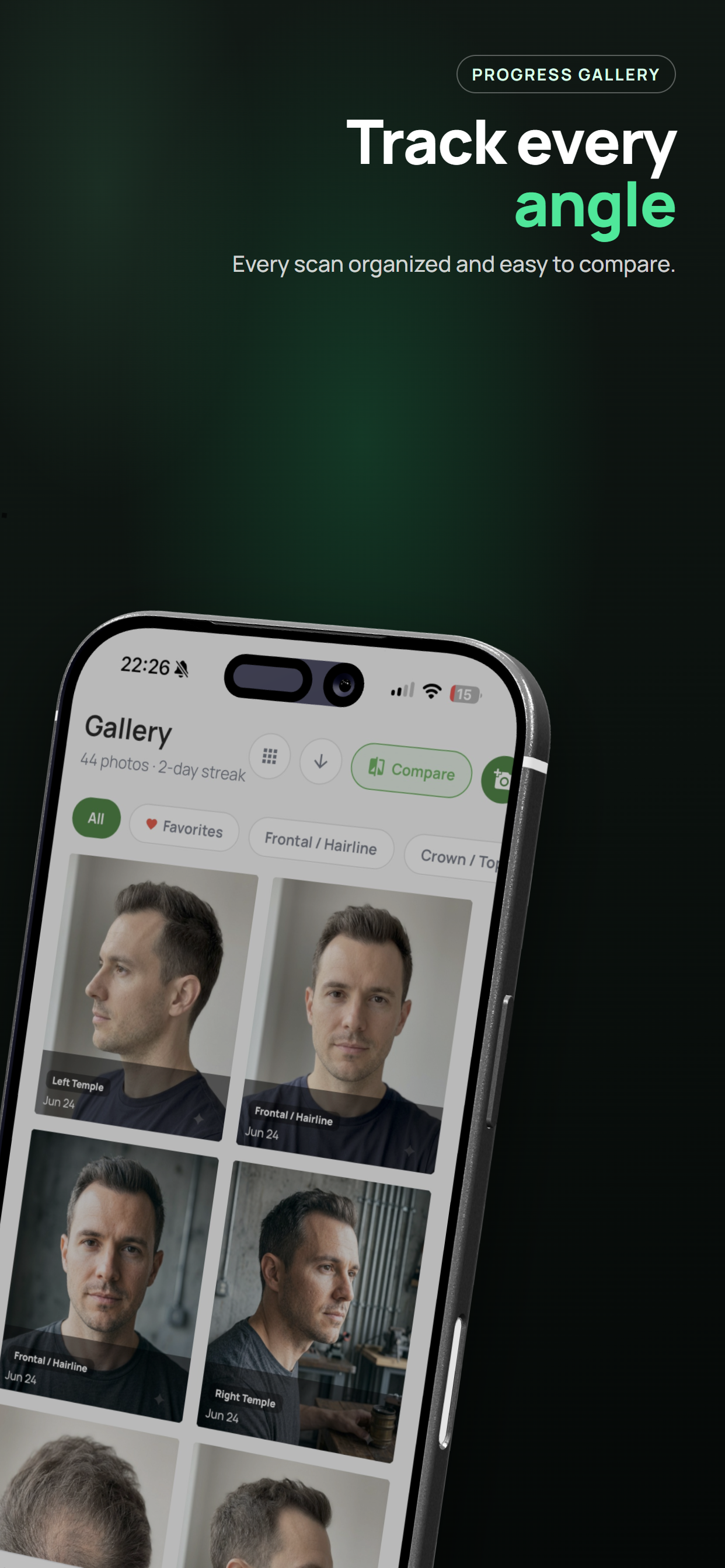 Trichometrics: Hair Loss AI screenshot 8