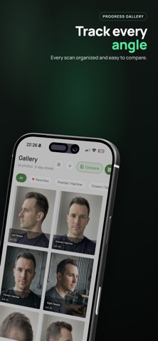 Trichometrics: Hair Loss AI screenshot