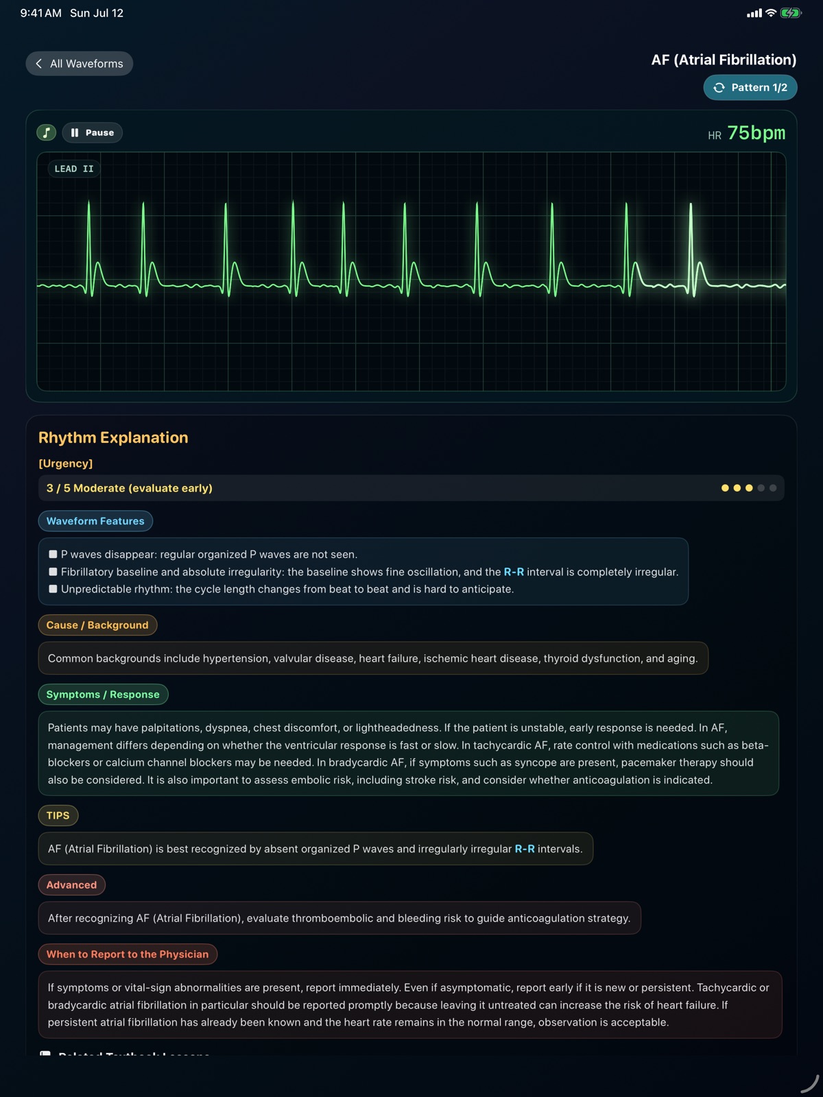 Monitor EKG Training ipad screenshot 2