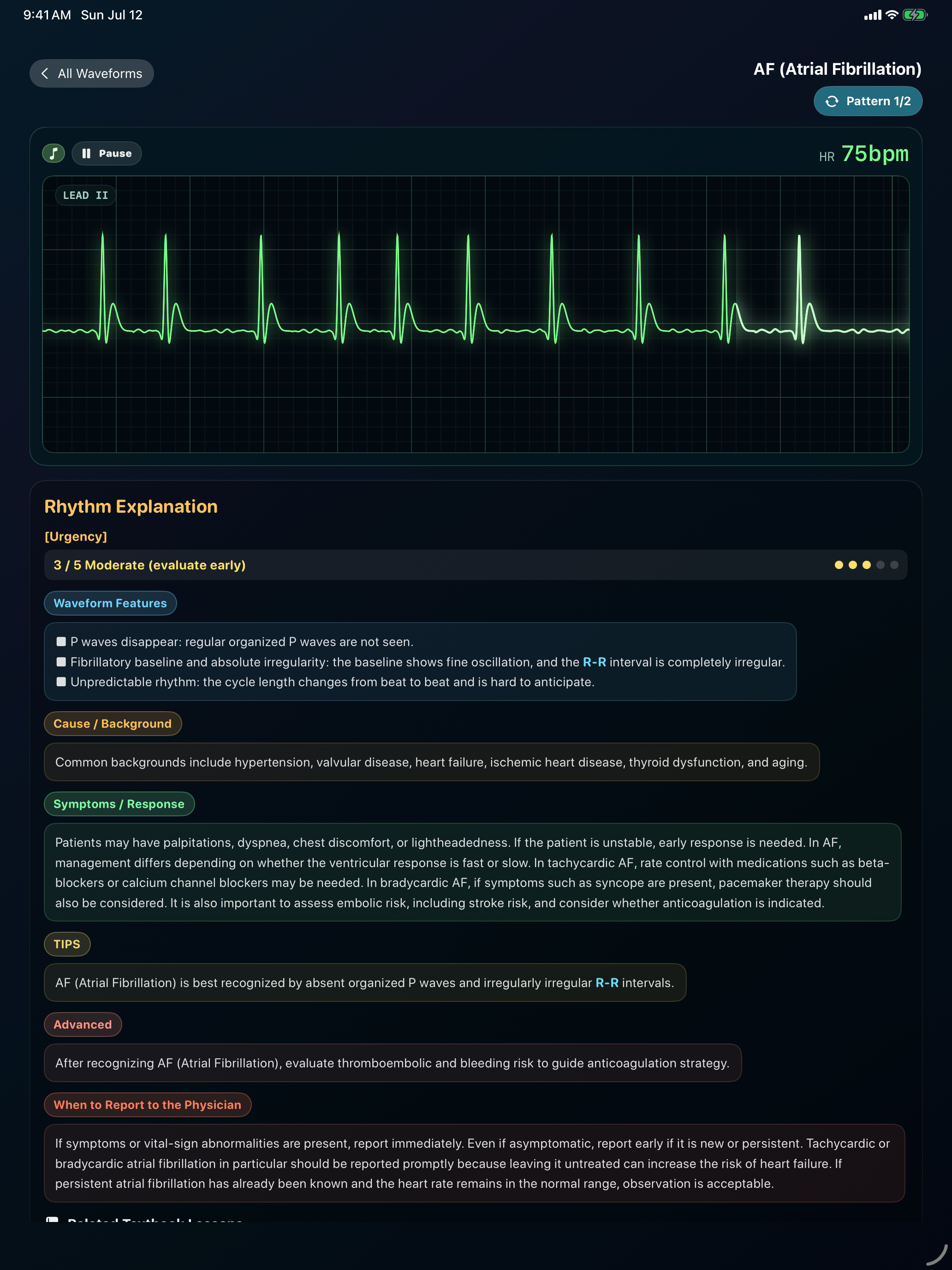 Monitor EKG Training screenshot 12