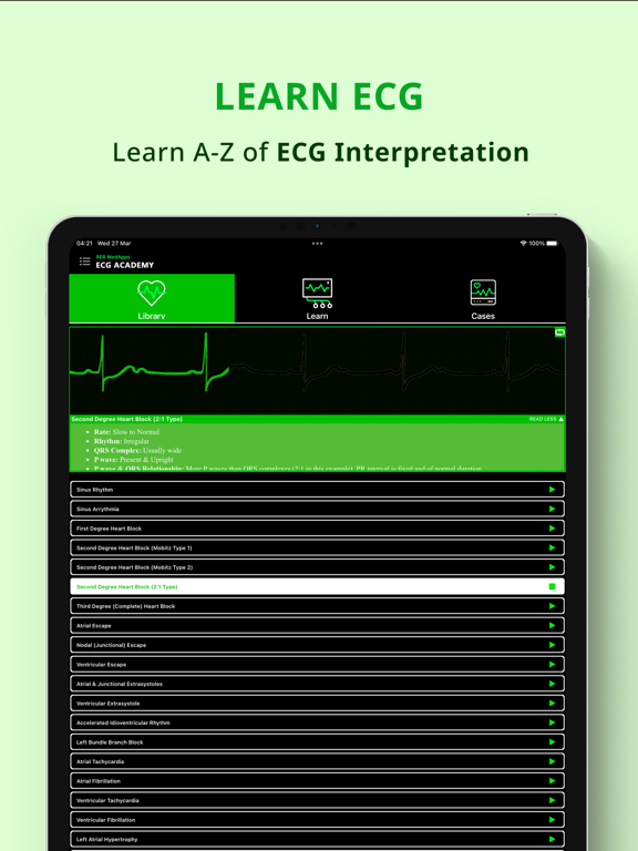 ECG for Doctors | EMT | AEMT iPad screenshot 4 - Medical app