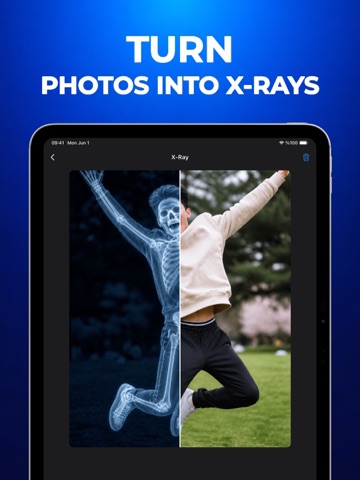 X-Ray Camera: XRayly iPad screenshot