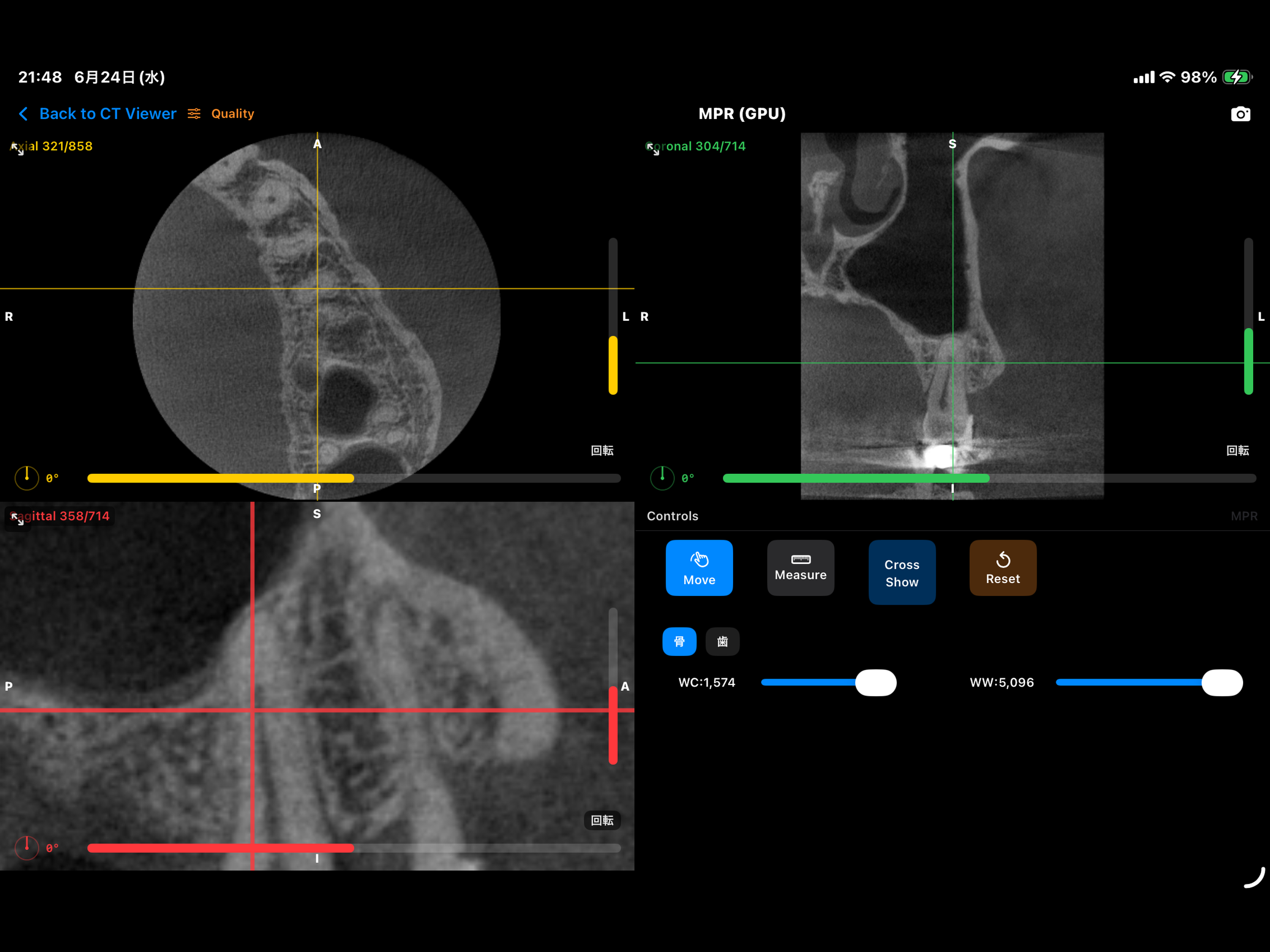 DentalCT screenshot 9