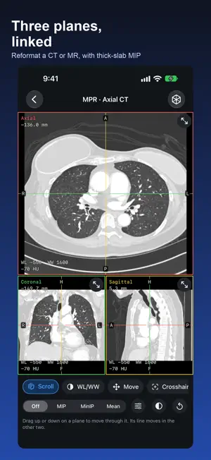 DICOM Viewer: DCM & MRI Reader screenshot 4