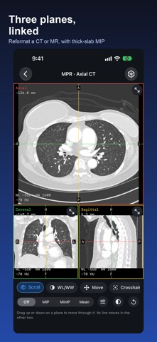 DICOM Viewer: DCM & MRI Reader Screenshot 4 of 6
