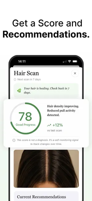Trez AI: BFRB & Hair Pulling screenshot 3