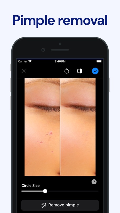 BeautyTune - Blemish Remover screenshot-0