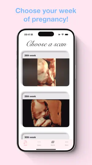 ScanBaby learn baby ultrasound screenshot 2