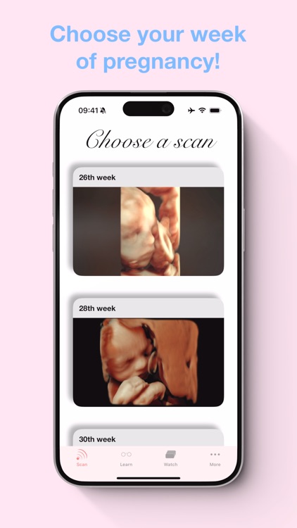 ScanBaby learn baby ultrasound