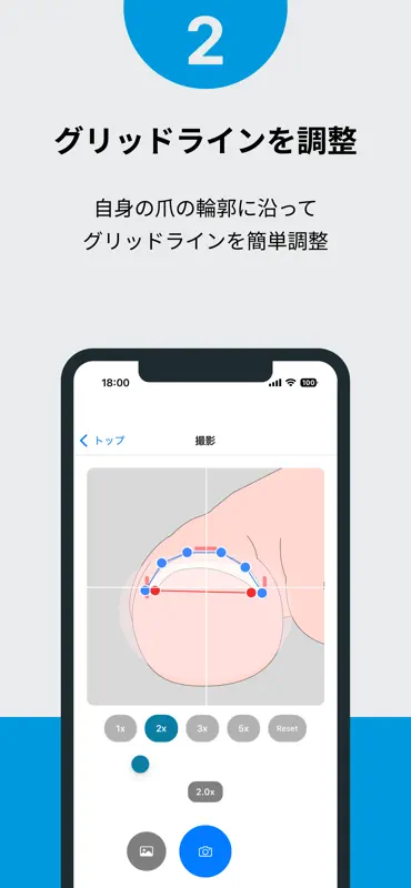 巻き爪チェッカー screenshot 3 of 4