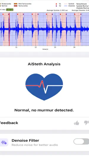 AiSteth screenshot 3