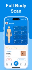 Mole Checker & Scanner: DermAi screenshot