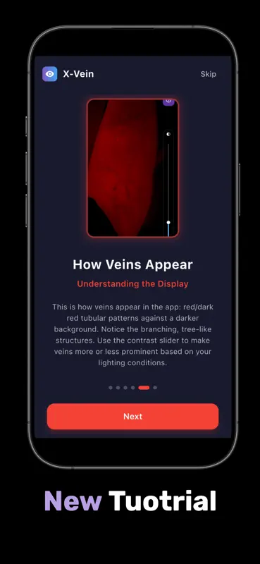 X-Vein screenshot 4 of 5