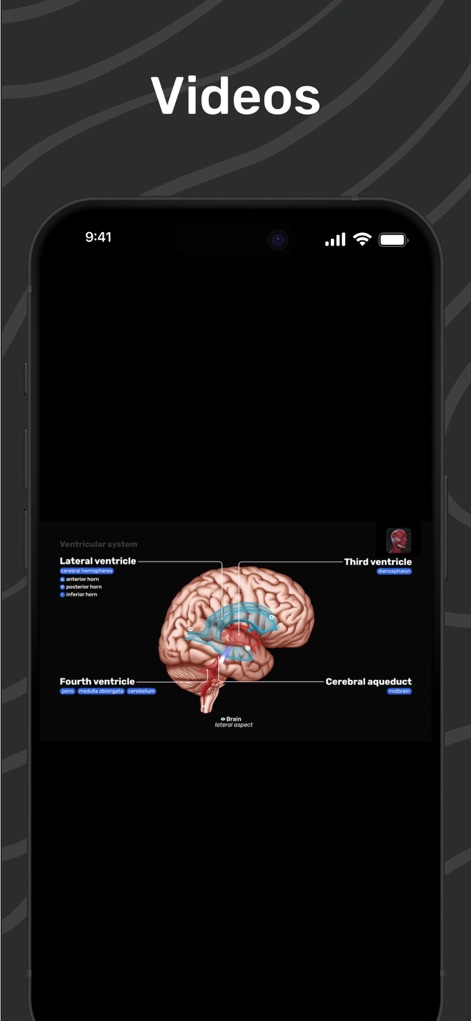 Easy Anatomy 3D - Access expert-made videos that break down complex topics, such as the ventricular system of the brain, with clear illustrations and animations.