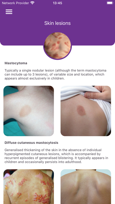 Systemic Mastocytosis Screenshot