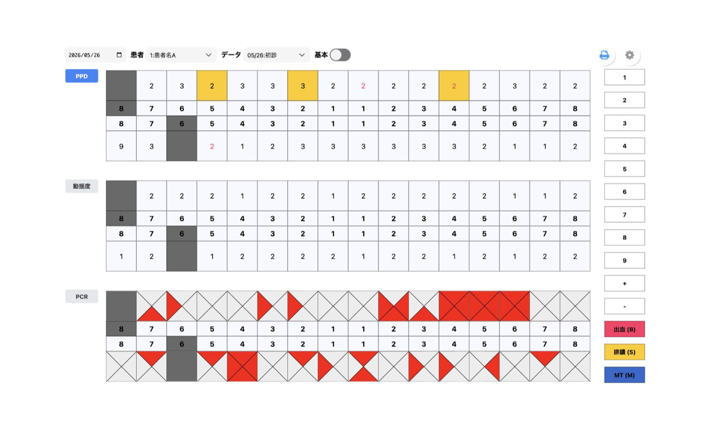 Periodontal Chart