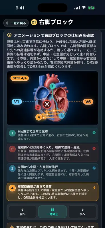 ECG Trainer: Monitor & 12-Lead screenshot 9 of 9