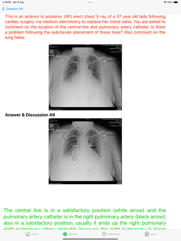 Screenshot #6 pour X-Ray Interpretation Guide