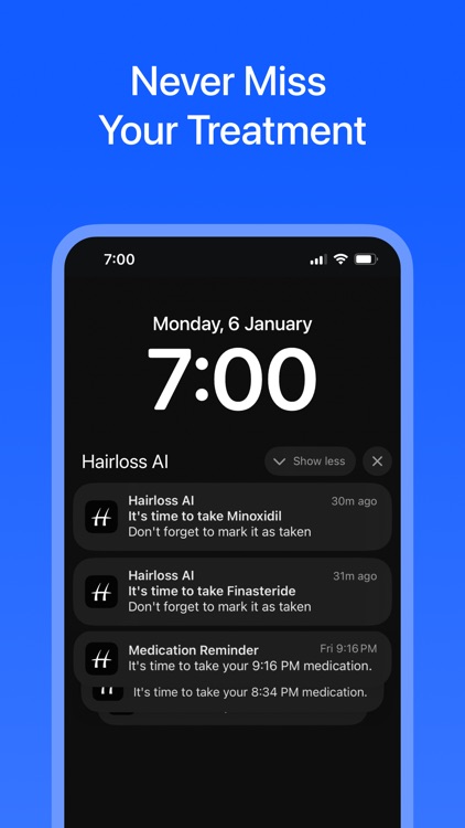 Hair Loss AI therapy & scanner screenshot-4
