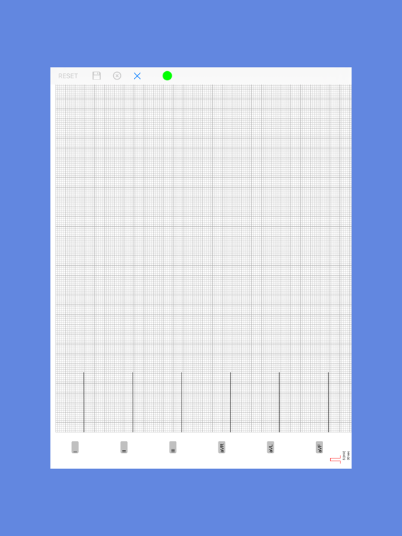 Screenshot #6 pour AIS ECG App
