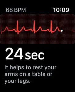 ECG screenshot #2 for Apple Watch