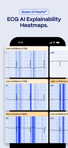 PMcardio for Individuals App Store preview screenshot 4
