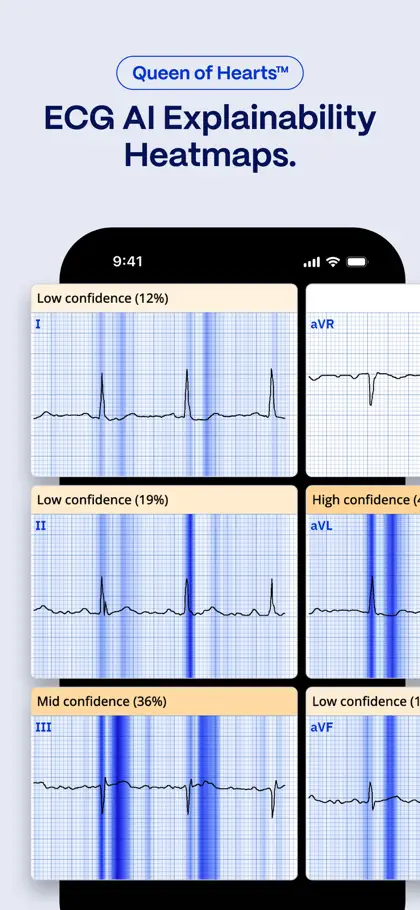 Screenshot 4 di 4 di PMcardio for Individuals
