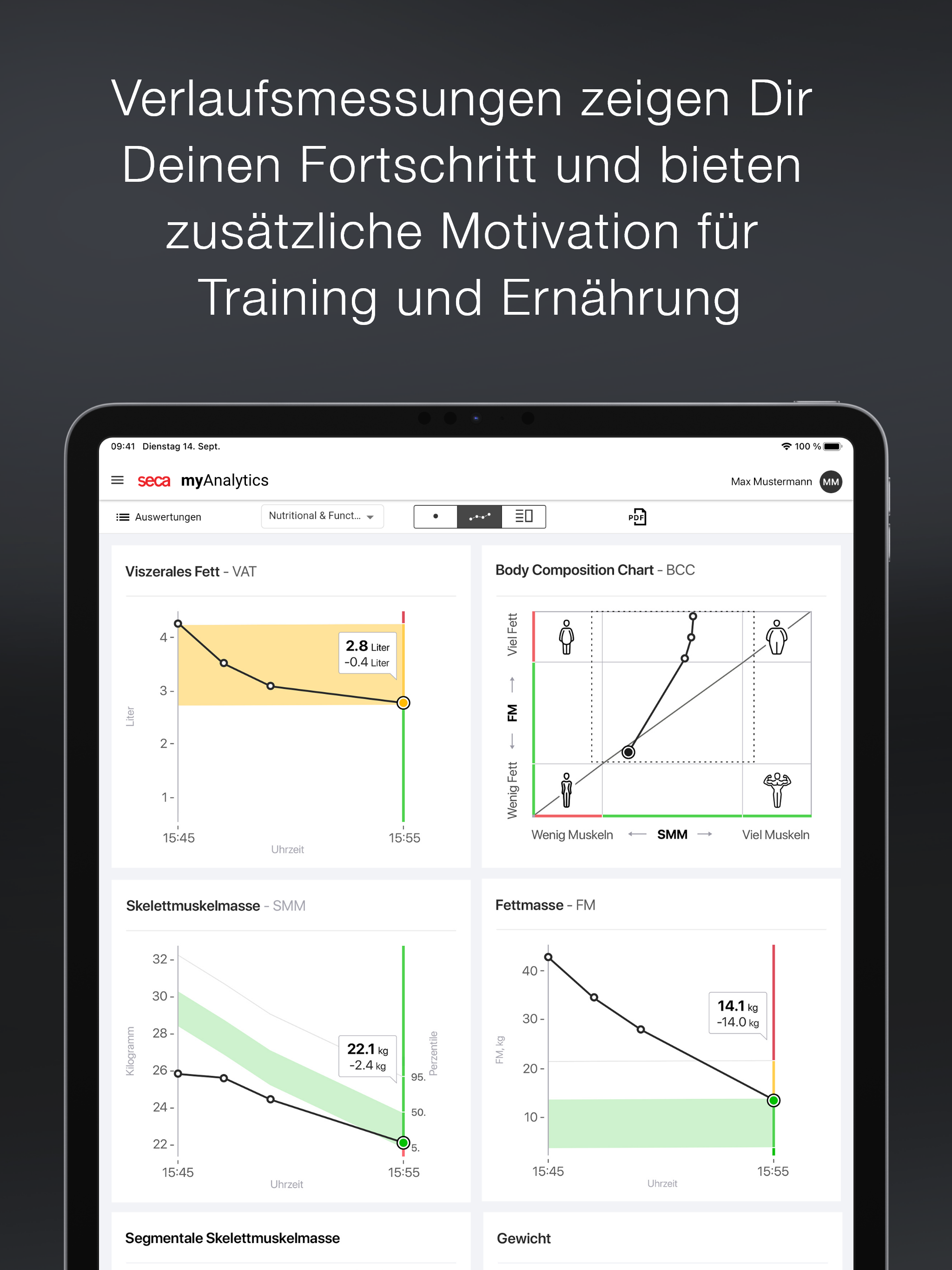 AI Translator-photo translate