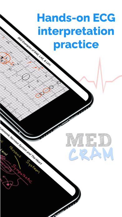 ECG / EKG Explained Clearly Screenshot 7 of 7