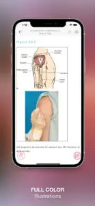 Nursing Skills & Procedures screenshot #4 for iPhone