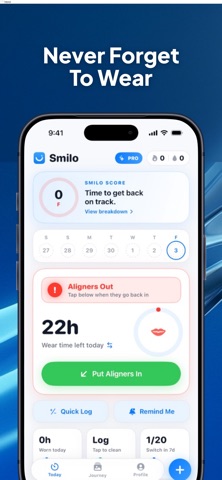 Smilo: Aligner Tracker Screenshot 1 of 6