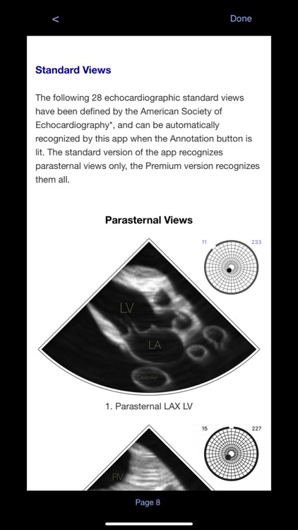 TTE PoCUS Simulator screenshot-5