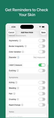 Mole Checker & Monitor iPhone screenshot