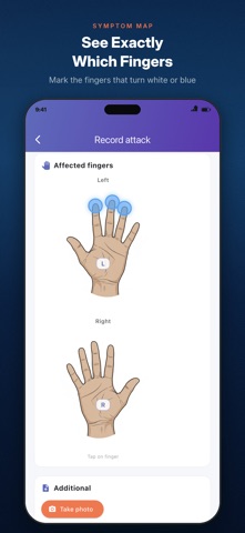 VasoLog: Raynaud's Tracker Screenshot 3 of 5