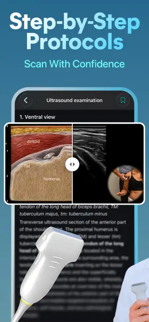 MSK Sono: Ultrasound Guide screenshot 2