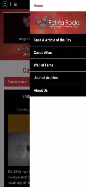 Retina Rocks screenshot 3