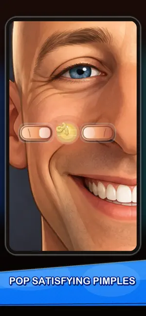 Pimple Popping Game screenshot 1