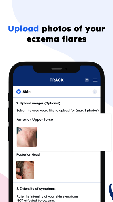 EczemaWise: Eczema Skin Care iPhone screenshot 6 - Health & Fitness app