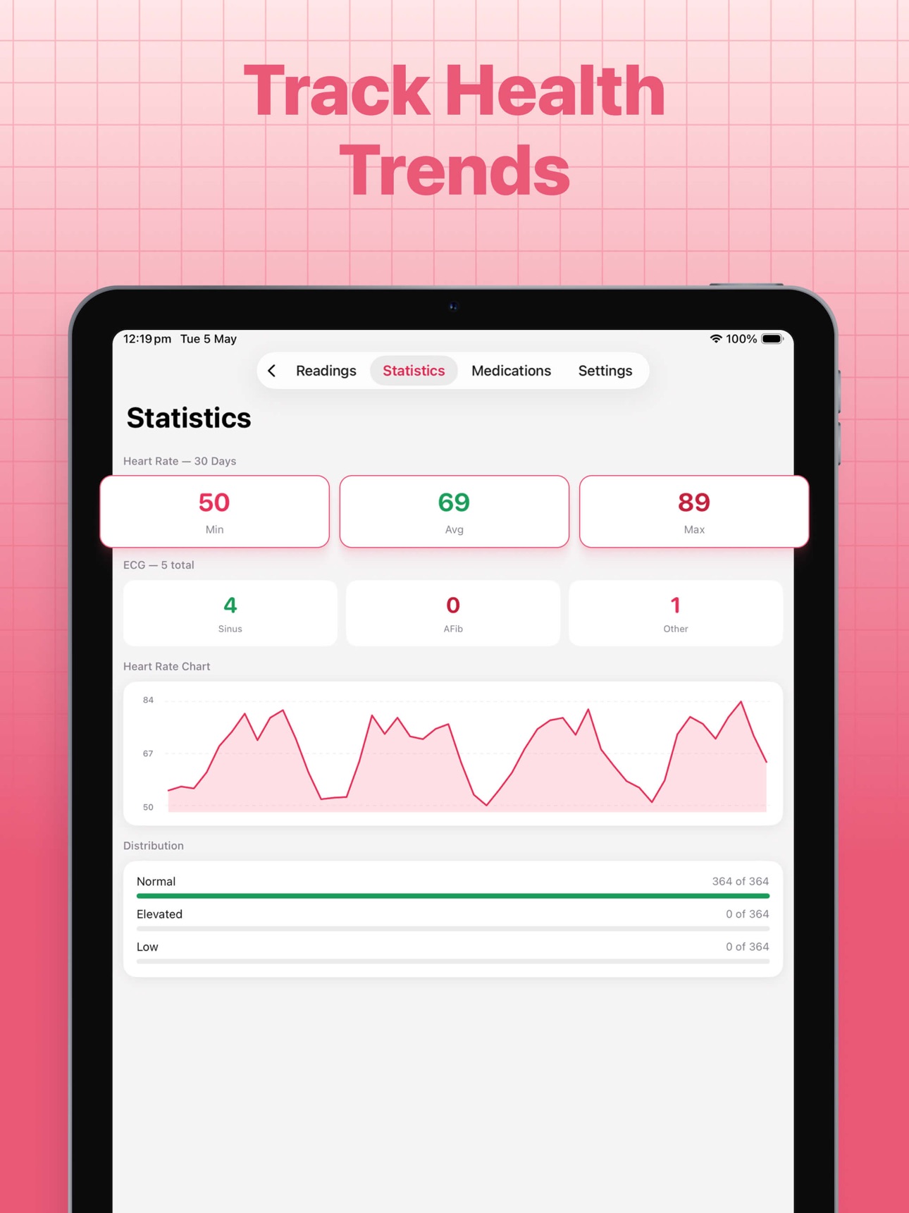 Screenshot 8 of ECG Heart Monitor Pro