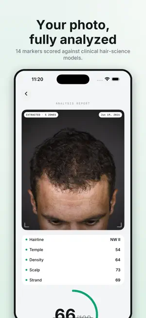 Folliq: AI Hair Scan screenshot 1