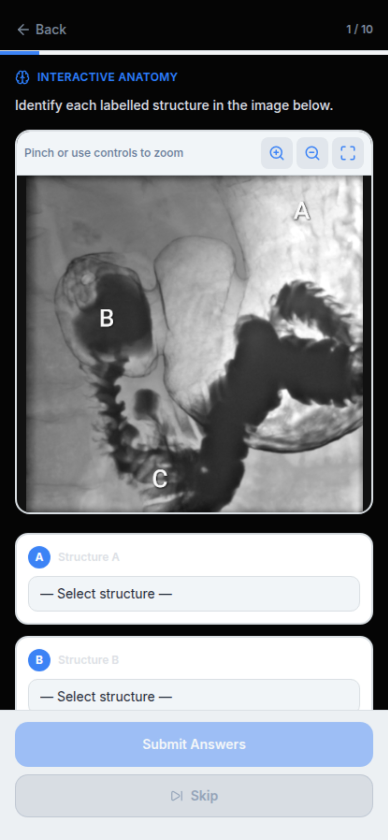 RadReady: Radiology Exam Prep screenshot 8