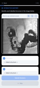 RadReady: Radiology Exam Prep screenshot