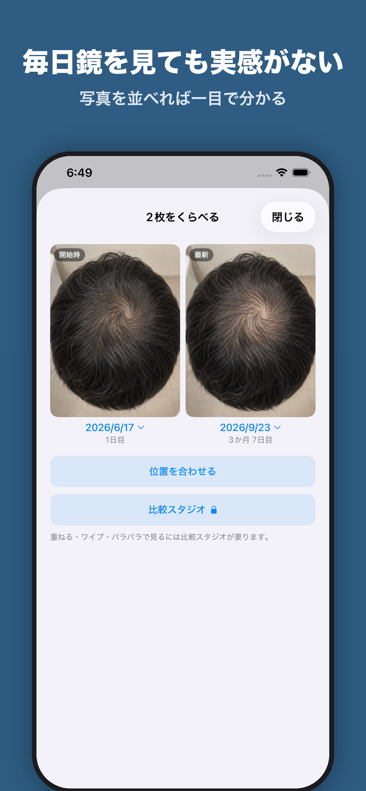 Screenshot 1 of 髪の経過ノート