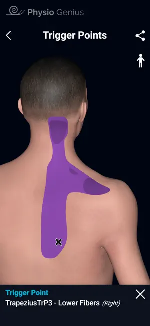 Physio Genius – 3D Maps screenshot 3