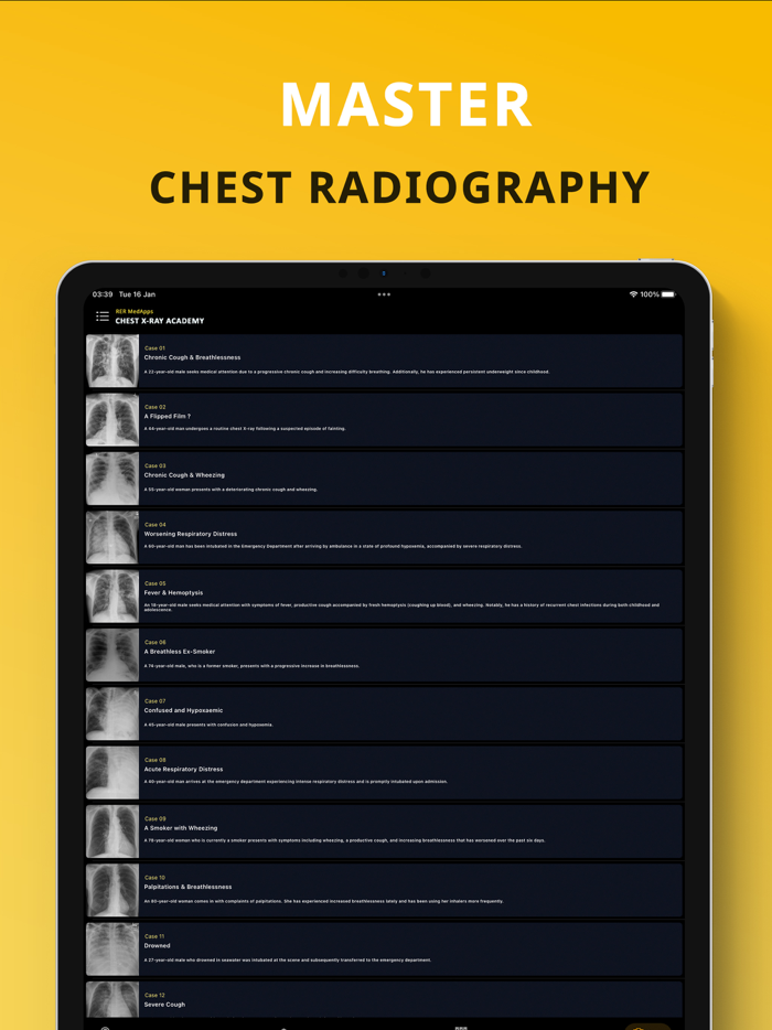 Chest X-ray Academy Learn CXR