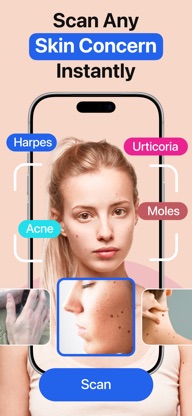 Mole Tracker: Skin Care App screenshot 1