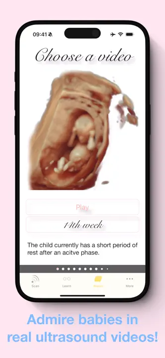 ScanBaby learn baby ultrasoundのスクリーンショット（8/8）