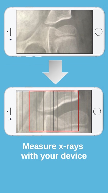 HipScreen screenshot-4