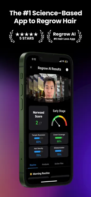 Regrow AI: Scan Hair Loss screenshot 1